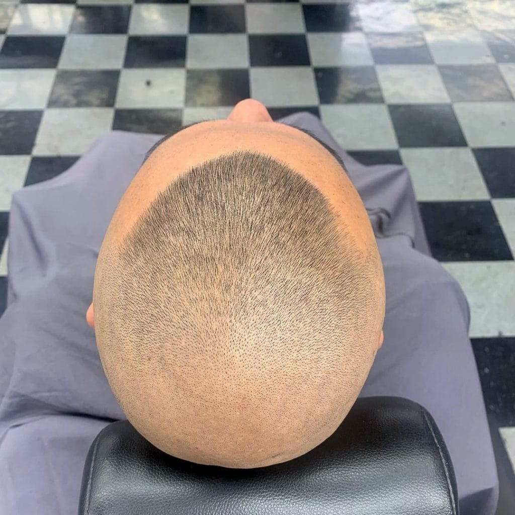 Bald southside fade haircut